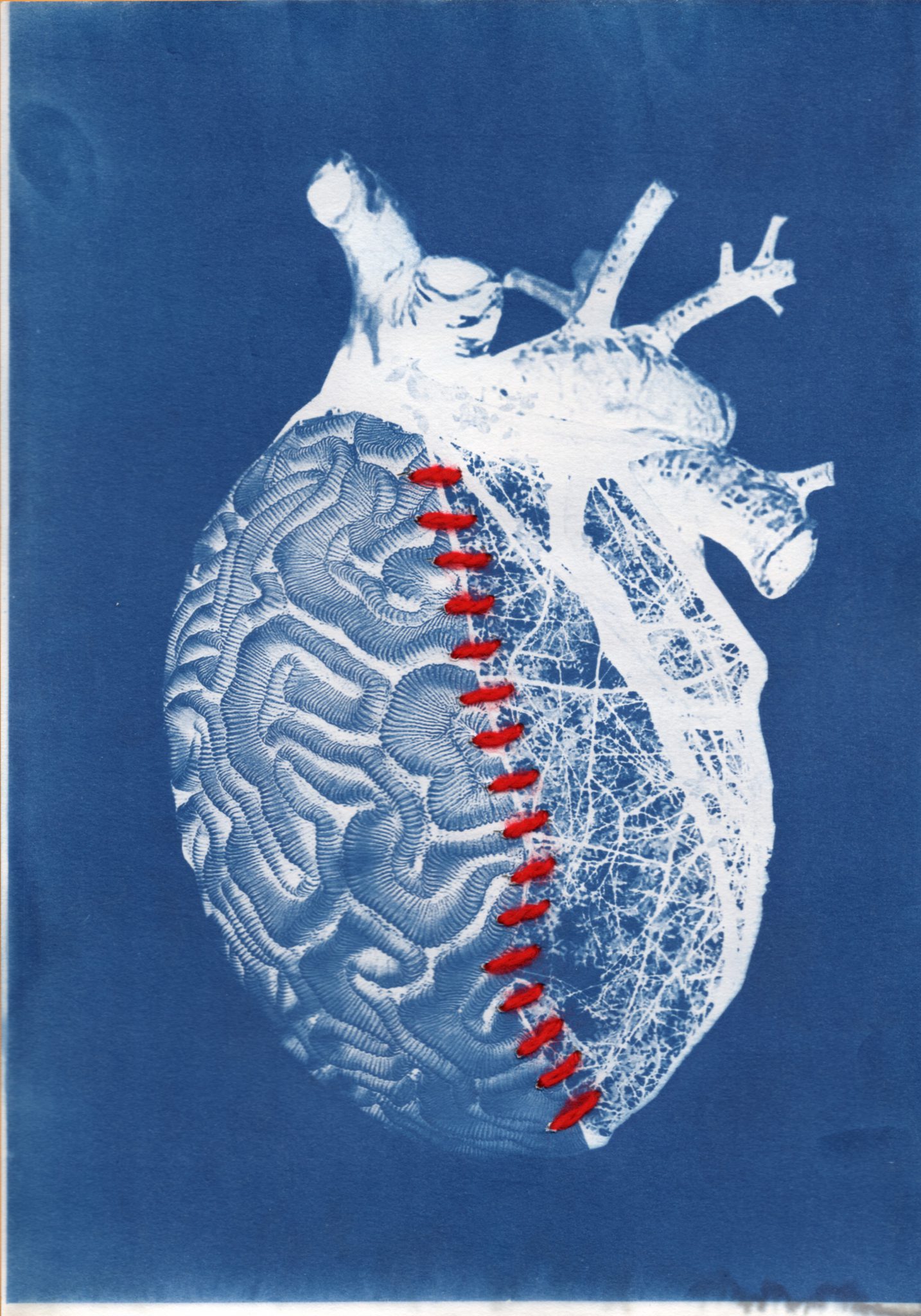 coeur-et-raison